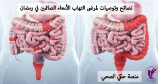 نصائح وتوصيات لمرضى التهاب الأمعاء الصائمين في رمضان